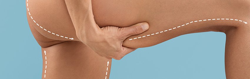 gluteoplastia em sp