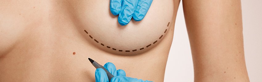 mamoplastia em sp