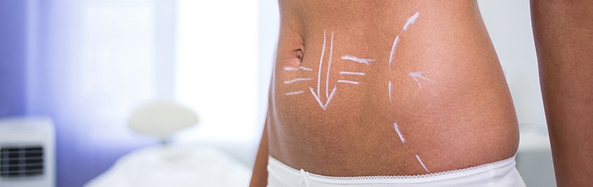 tratamento para flacidez em sp