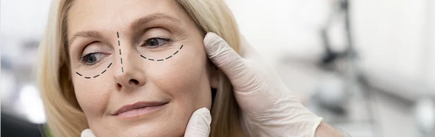 Cirurgia pálpebras caídas (Blefaroplastia) em SP